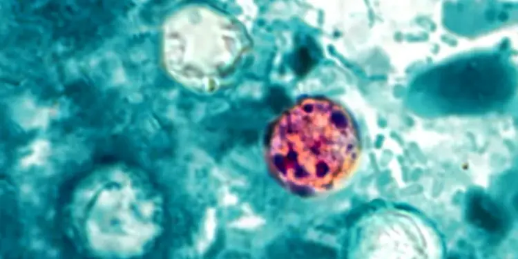 Michigan Reports Two Deaths in Cyclosporiasis Outbreak