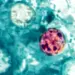 Michigan Reports Two Deaths in Cyclosporiasis Outbreak