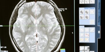 Musiala Faces Neurological Dysfunction, Second Collapse in Four Days
