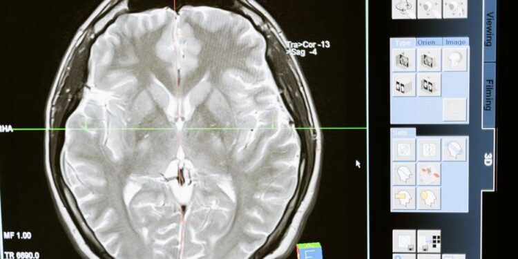 Musiala Faces Neurological Dysfunction, Second Collapse in Four Days