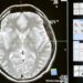 Musiala Faces Neurological Dysfunction, Second Collapse in Four Days