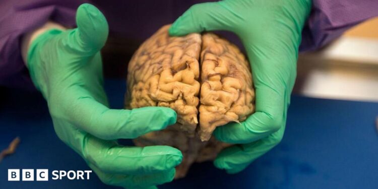 NFL: At Least One in Four Ex-Players Had Brain Disease, Says Study