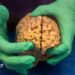 NFL: At Least One in Four Ex-Players Had Brain Disease, Says Study