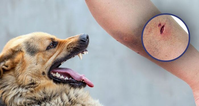Rabies Threatens Lives: Livestock Losses Triggering Crisis in Western and Western North