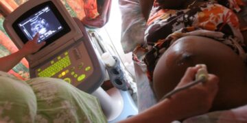 Trump Administration Cuts to HIV/AIDS Funding Triggering Disruptions Across Africa